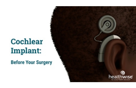 Cochlear Implant: Before Your Surgery