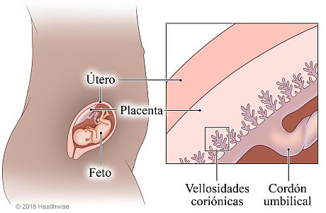 Feto en el útero, con detalle de la placenta que muestra las vellosidades coriónicas y el cordón umbilical