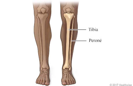Imagen de los huesos de la parte inferior de la pierna