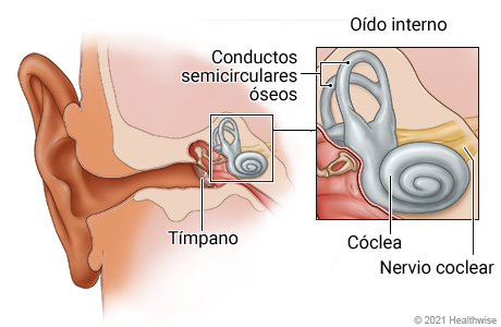 El oído, que muestra el oído interno junto al tímpano, con un primer plano del oído interno y los conductos semicirculares óseos, la cóclea y el nervio coclear.