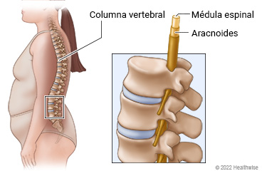 Ubicación de la columna vertebral, con vista de primer plano de la médula espinal rodeada por la membrana aracnoidea.