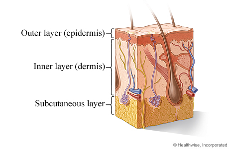 Cross section of the skin.