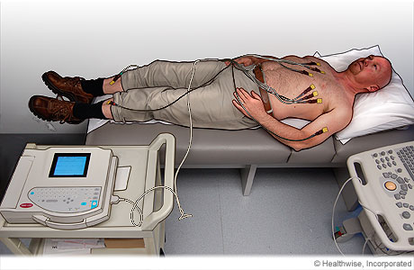 Colocación de electrodos para ECG