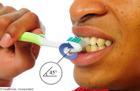 Sostener un cepillo de dientes en un ángulo de 45 grados