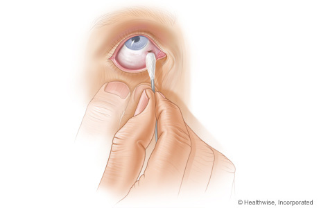 Cómo quitar un objeto del ojo