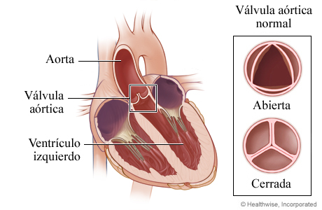 Ubicación de la válvula aórtica en el corazón y detalle de válvula abierta y cerrada