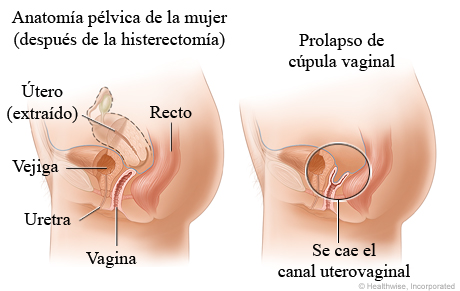 Partes de la vagina  ¿Qué es la vulva?