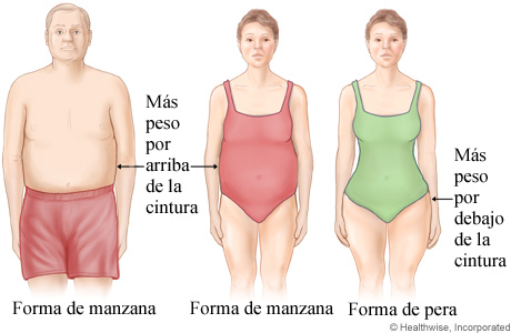 Imagen de distribución de grasa corporal en forma de manzana y de pera