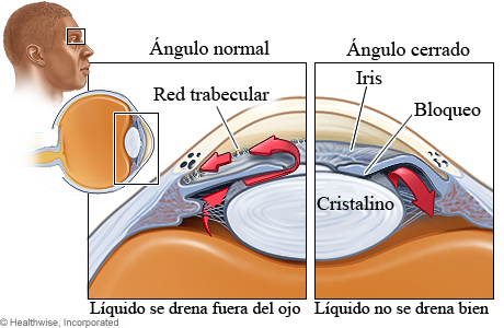 Imagen de las estructuras afectadas por el glaucoma de ángulo cerrado