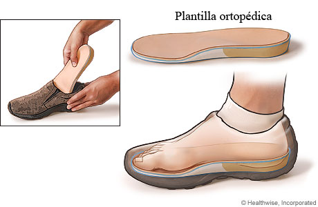 Vista del pie dentro del zapato descansando sobre la plantilla ortopédica, con detalle de la colocación de la plantilla en el zapato