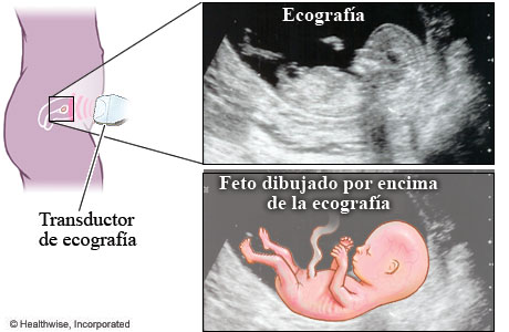 Imagen y foto de una ecografía fetal