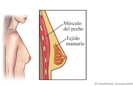 Vista lateral de un seno femenino con detalle del músculo pectoral y tejido mamario.