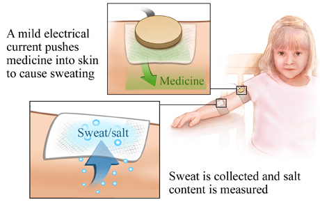 Picture of the sweat test procedure