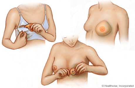 Types of breast forms Video & Image