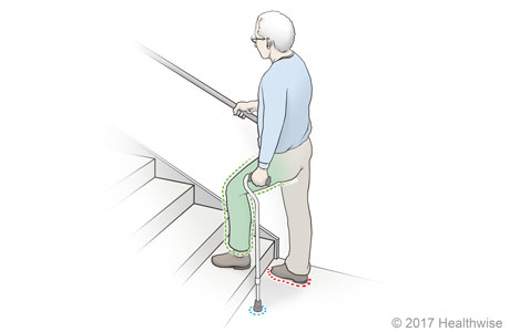 Going up stairs with a cane.
