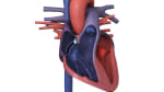 Catheter Ablation for SVT: Before Your Procedure