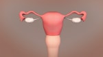 Hysterectomy: Before Your Surgery