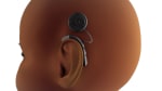 Your Child's Cochlear Implant: Before Surgery