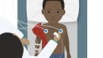 Echocardiogram for Children
