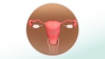 Mittelschmerz (pain during ovulation): Fast facts