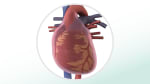 Pericarditis: Fast Facts