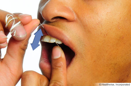 Persona utilizando hilo dental, mostrando el movimiento del hilo hacia arriba y hacia abajo entre los dientes.