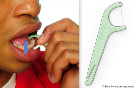 Persona utilizando un instrumento para usar el hilo dental, moviéndolo hacia arriba y hacia abajo entre dos dientes.