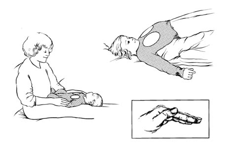 Drenaje postural para los lóbulos inferiores (segmento anterior)