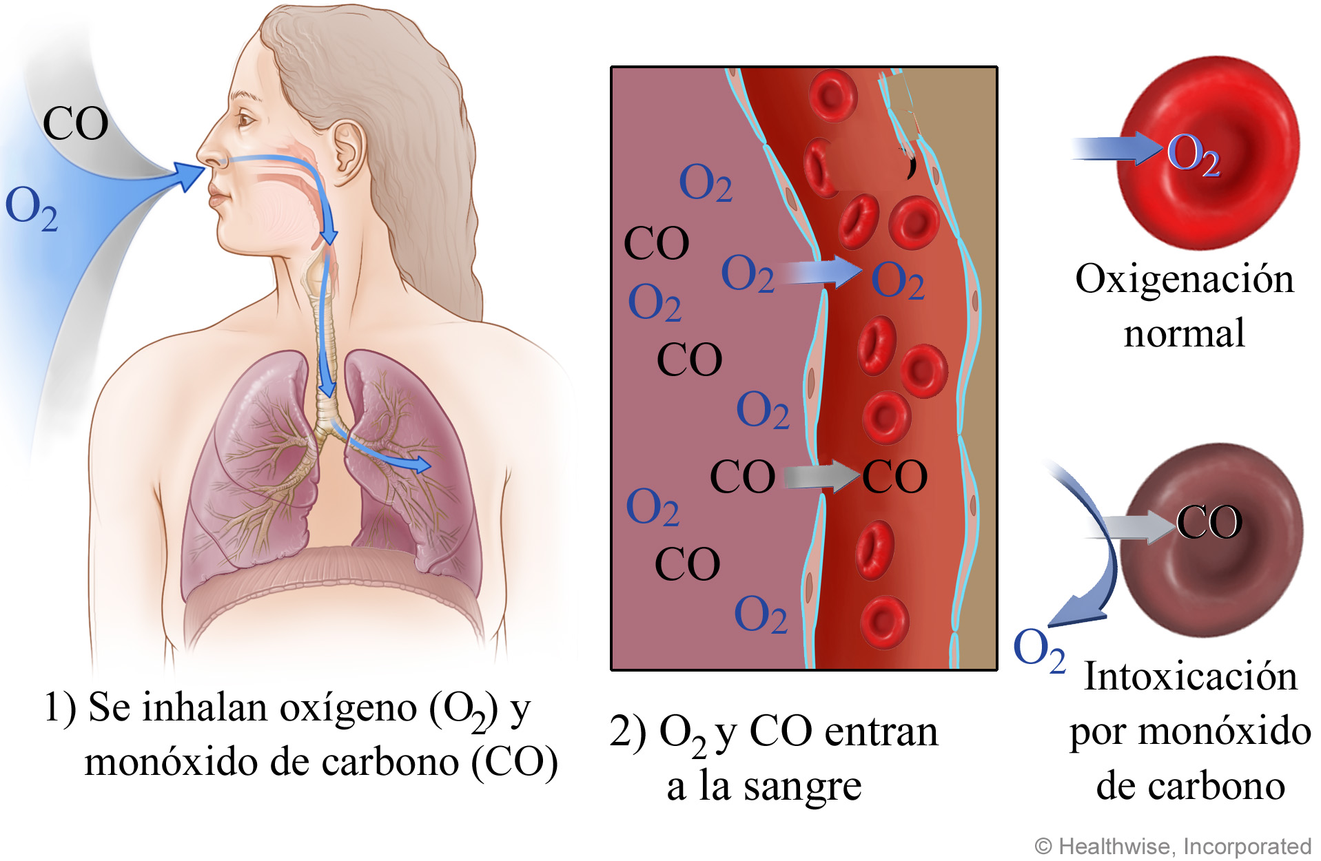 Imagen de lo que sucede en las células sanguíneas durante la intoxicación por monóxido de carbono