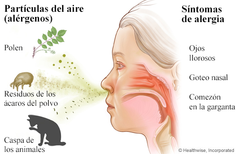 Respirar polen, residuos de los ácaros del polvo y caspa de los animales, y los síntomas de alergia que estos provocan