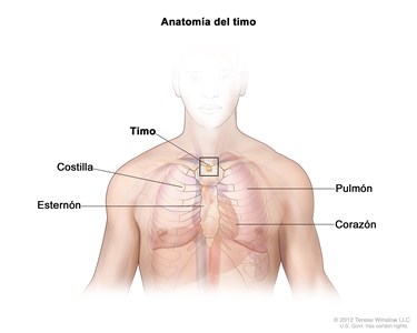 Anatomía del timo; el dibujo muestra el timo en la parte superior del pecho, bajo el esternón. También se muestran las costillas, los pulmones y el corazón.