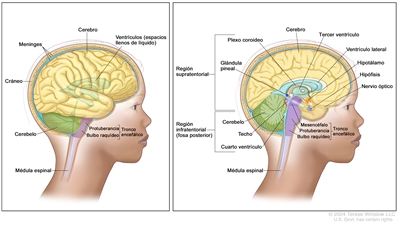 Anatomía del encéfalo. Dibujo dividido en dos paneles. En el panel derecho se observa el interior de la cabeza de una niña donde se señalan las dos regiones del encéfalo: supratentorial en la porción superior e infratentorial (fosa posterior) en la porción inferior y posterior. En la región supratentorial, se señala el cerebro, un ventrículo lateral, el tercer ventrículo con el líquido cefalorraquídeo en azul, el plexo coroideo, la glándula pineal, el hipotálamo, la hipófisis y un nervio óptico. En la región infratentorial (fosa posterior), se señala el cerebelo, el techo del mesencéfalo, el cuarto ventrículo y las tres partes del tronco encefálico: mesencéfalo, protuberancia y bulbo raquídeo. También se señala la médula espinal. En el panel izquierdo se observa el interior de la cabeza de una niña donde se señalan el cerebro, los ventrículos (espacios llenos de líquido), las meninges, el cráneo, el cerebelo, la médula espinal y dos partes del tronco encefálico: protuberancia y bulbo raquídeo.