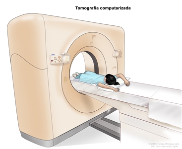 Tomografía computarizada (TC) del abdomen; en la imagen se observa a un niño en una camilla que se desliza al escáner de TC, que toma imágenes radiográficas del interior del cuerpo.
