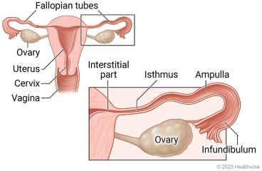 Female reproductive organs, including vagina, cervix, uterus, ovaries, and fallopian tubes, with detail of areas of fallopian tubes.