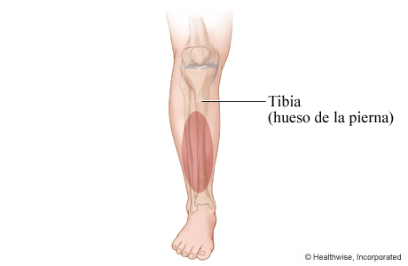 Ubicación de los dolores en las espinillas