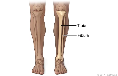 Skeletal view of bones of lower leg, the tibia and fibula (shinbone)