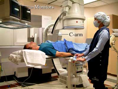 How an angiogram is done