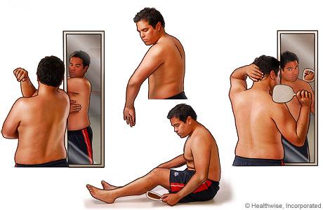 Methods of skin self-examination.