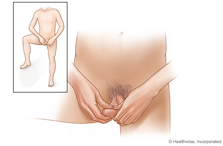 pediatric exam genital 