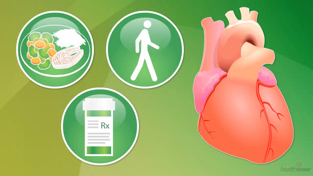 Coronary Artery Disease and Depression