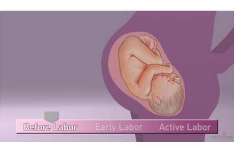 Signs of Labor