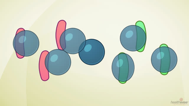 Why You Don't Need Antibiotics for Bronchitis