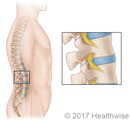 La columna vertebral