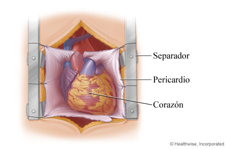 Separador que deja expuesto el corazón en el pecho