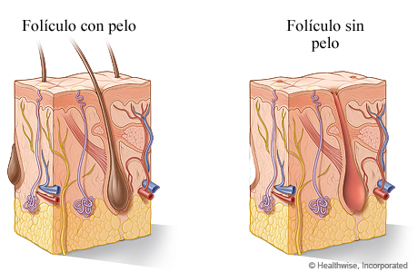 Folículo piloso con pelo y sin pelo