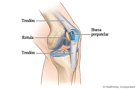 Bursitis de la rodilla