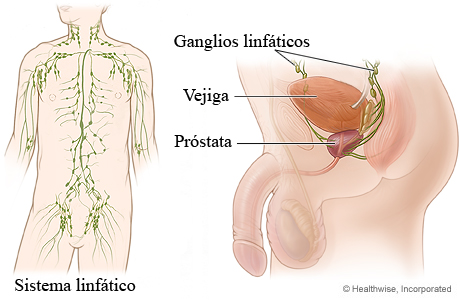 Imagen de los ganglios linfáticos en el retroperitoneo y la pelvis del hombre