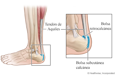 Bolsa retrocalcánea y bolsa subcutánea calcánea