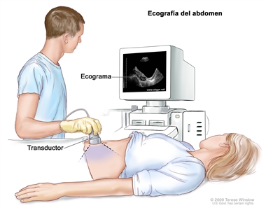 Ecografía abdominal; la imagen muestra a una mujer sobre una camilla durante un procedimiento de ecografía abdominal. Se ve a un ecografista de diagnóstico (persona capacitada para realizar procedimientos de ecografía) pasando un transductor (instrumento que produce ondas de sonido que rebotan en los tejidos del interior del cuerpo) sobre la superficie del abdomen de la paciente. Una pantalla de computadora muestra un ecograma (imagen computarizada).