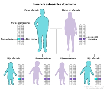 En la imagen se observa la distribución del tipo de herencia autosómica dominante en una familia conformada por padre, madre y cuatro hijos: se muestran un par de cromosomas con un gen mutado y un gen normal en el padre afectado; dos genes normales en la madre no afectada; un gen mutado y un gen normal en una hija afectada y en un hijo afectado; y dos genes normales en una hija no afectada y en un hijo no afectado.